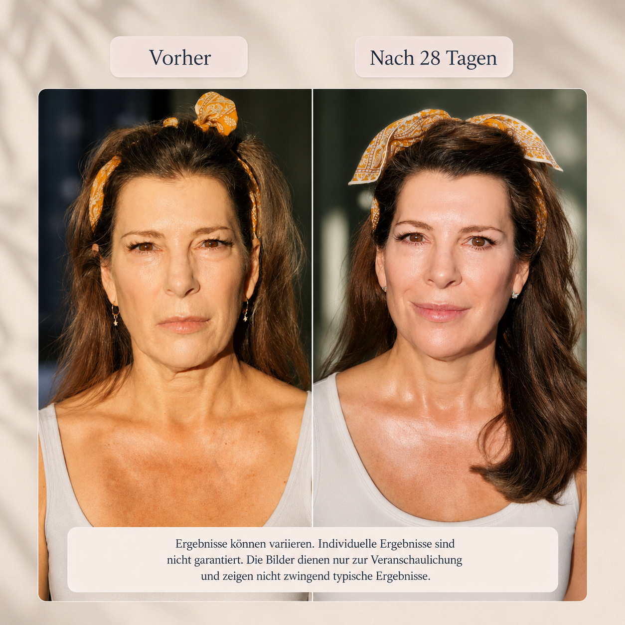 Auralis EyeLift